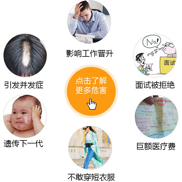 南昌白癜风专家告诉你白癜风的治疗方法是什么哇 南昌白癜风医院怎么样