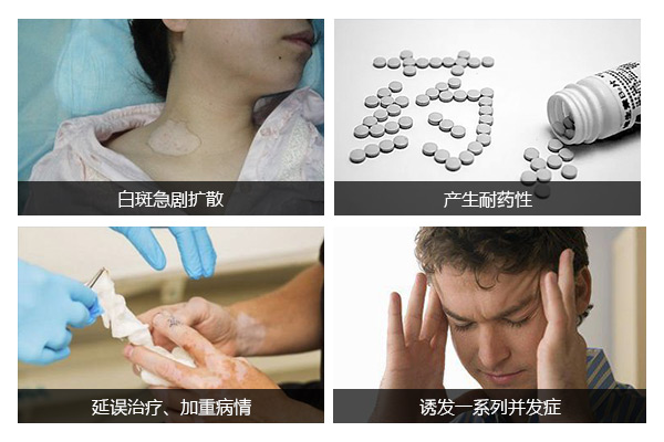 长期的晒太阳会让男性身上出现白癜风吗?