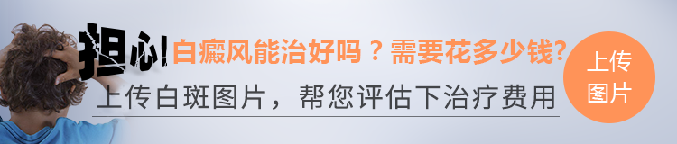 白癜风患者要注意哪些生活习惯呢?