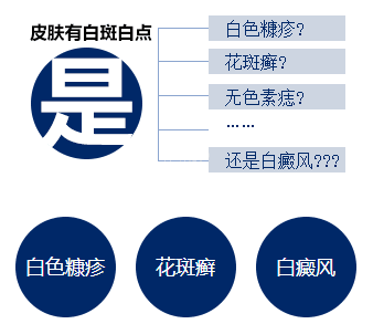 如何诊断是否得了白癜风?