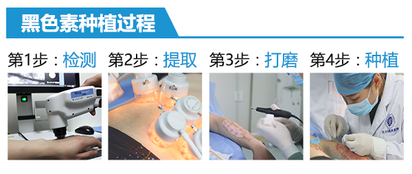白癜风到底怎样能确诊？南昌治疗白癜风医院