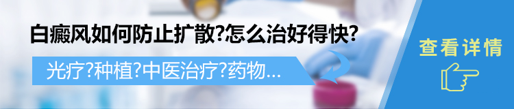 疗泛发型白癜风要注意什么?