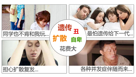 白癜风的病情会恶化吗？