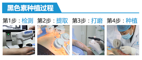 男性白癜风初期白斑症状是什么样？南昌治白癜风最好的医院