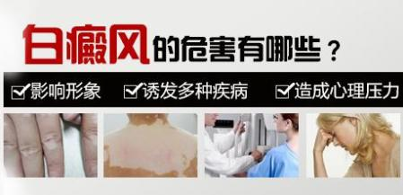 晕痣型白癜风怎么治疗？