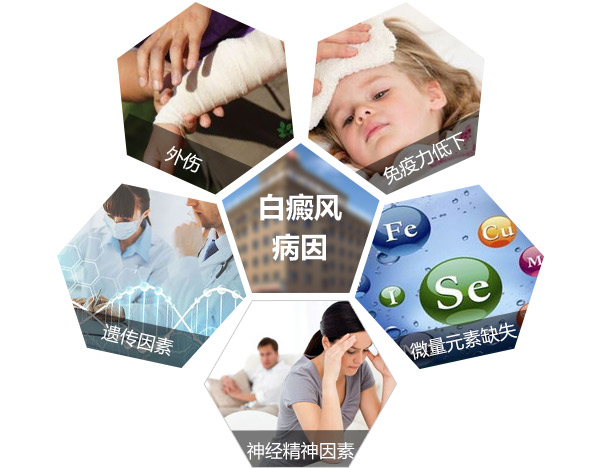 白癜风发病的诱因有哪些方面