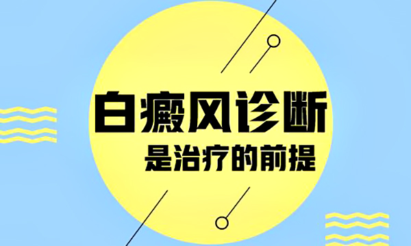 白癜风患者要怎么判断白癜风症状