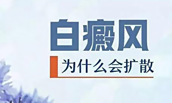 白癜风治疗过程中会扩散吗