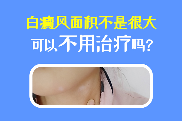 白癜风危害小不治疗也行?