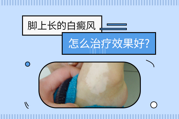 手脚处的白癜风为什么难医治?