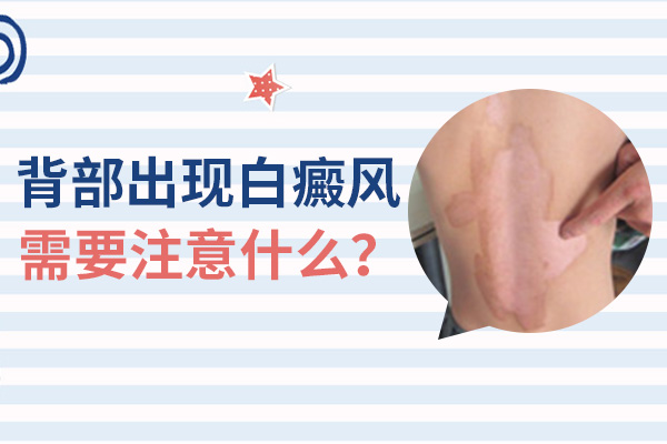 海口白癜风医院在哪 背部有白癜风需要注意什么
