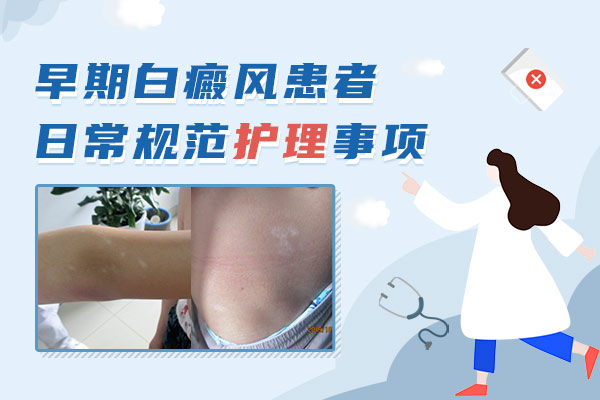 白癜风患者的伤口应该如何护理