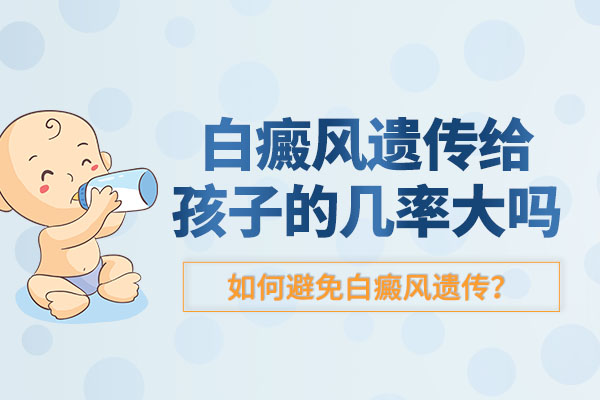 白癜风会遗传给后代吗?