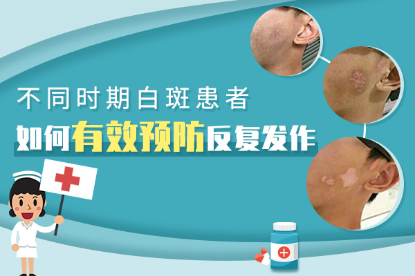 治疗白癜风需要做哪些辅助工作?
