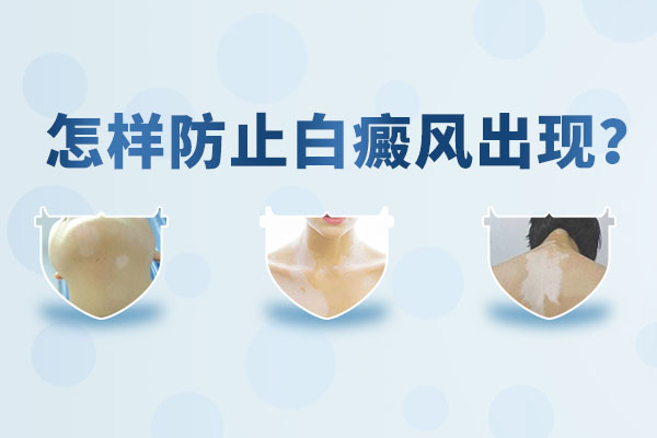 如何避免孩子患上白癜风?
