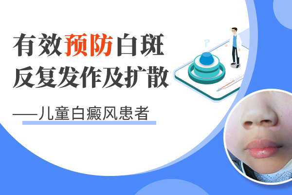 如何治疗儿童白斑?