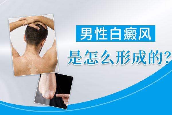 上海引起颈部患有白斑是因为什么
